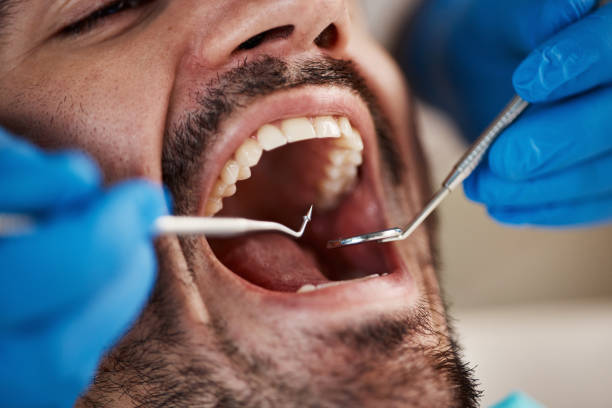 Best Emergency Tooth Extraction in Macclenny, FL